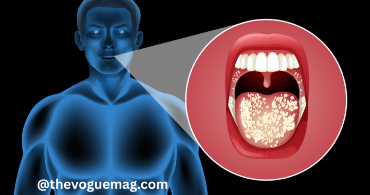 adenoidid